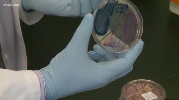 Experts warn of "superbug" threat