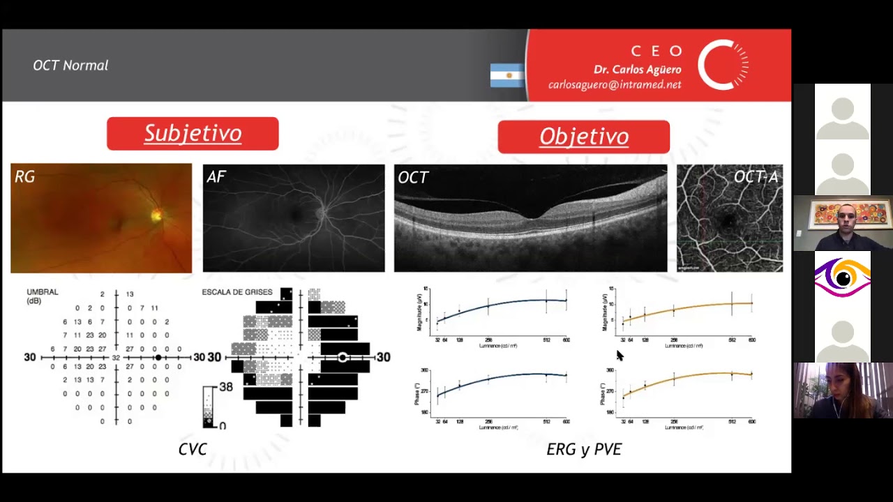Curso OCT y OCT A Módulo 2 YouTube Curso OCT y OCT A Módulo 2 YouTube