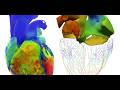 Revolutionizing Medicine: How Virtual Twins are Saving Lives and Transforming Healthcare