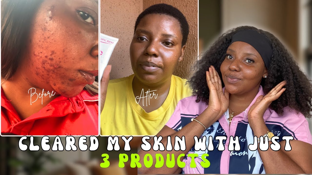 HOW I CLEARED MY SKIN WITH JUST 3 PRODUCTS IN 3 MONTHS - YouTube