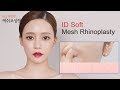 Korea rhinoplasty before and after l id hospital korea