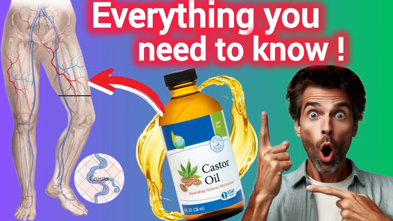 Castor Oil for Varicose Veins - Everything you need to know - YouTube