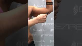 Arm Liposuction and Tummy Tuck marking