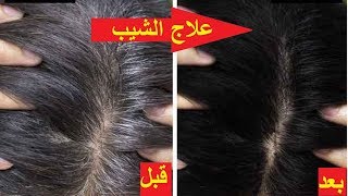 وصفة لازالة الشعر الابيض نهائيا تخلي الشعر اسود كما كان من قبل !!!!