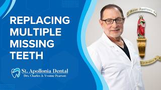 What Are My Options for Replacing Multiple Missing Teeth? | Mini Dental Implants in Sterling Heights