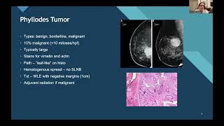 SSAT Resident & Fellows Education Committee Webinar: High-Yield Topics for the ABSITE 2026: Part 1