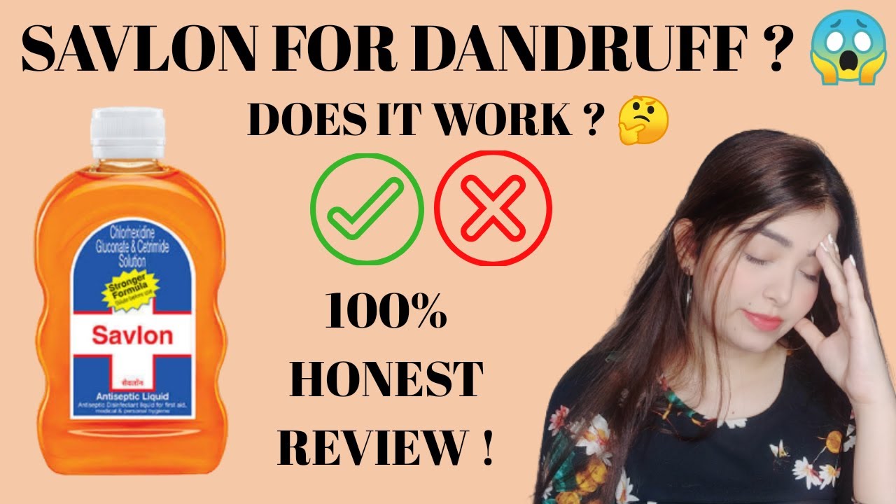 I Used Savlon In My Hair To Remove Dandruff For 30 Days And This I Used Savlon In My Hair To Remove Dandruff For 30 Days And This