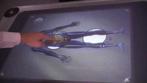 Microsoft Surface : AFTER-MOUSE.COM created a new application dedicated to Health Care (v2)