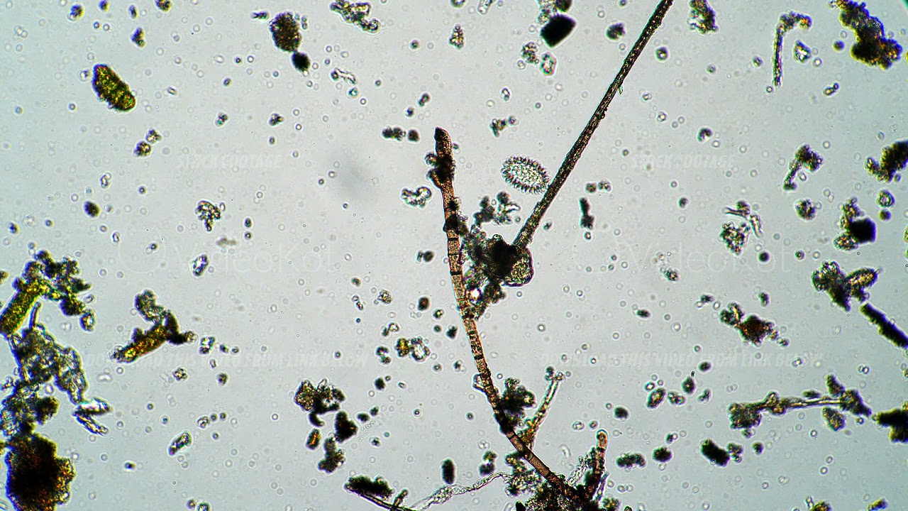 Moss piglet is crawling over the one stick near to another under the microscope