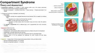 Compartment Syndrome Overview 💪 Presentation, Diagnosis, &amp; Treatment