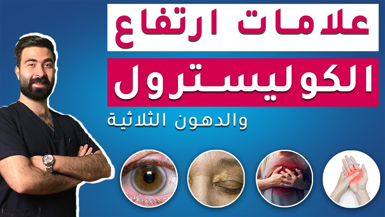 انتبه.. 7 علامات خطيرة تدل على ارتفاع الكوليسترول والدهون الثلاثية || تنظيف الشرايين من الدهون !