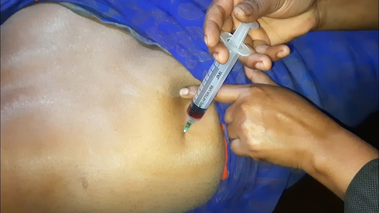 b12 injection in buttocks video Buttock Vitamin b1,b6,b12 