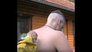 Пчелиное Ужаливание в Голову при рассеянном склерозе Пчелиное Ужаливание в Голову при рассеянном склерозе