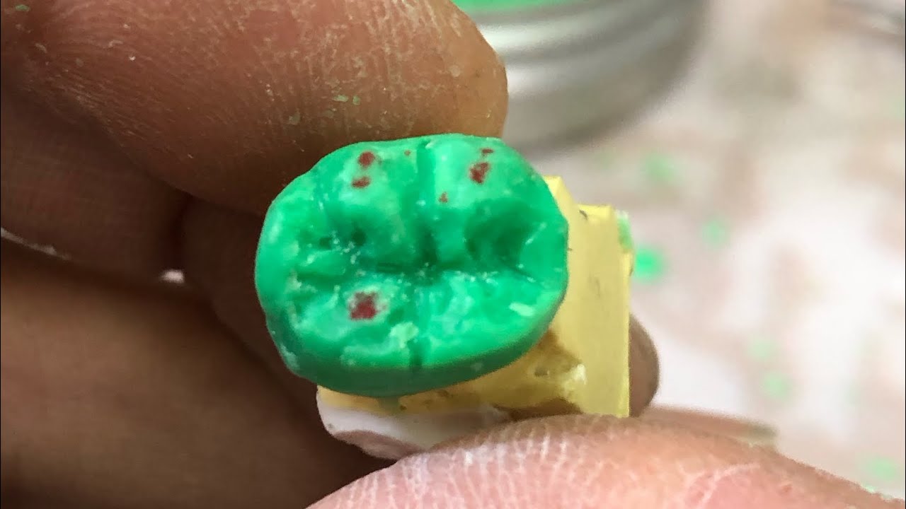 🔰学生向け　下顎6   ワックスアップ