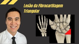 Lesão Da Fibrocartilagem Triangular O Que É E Como Acontece Essa Dor No Punho?