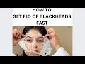 HOW TO: Get Rid of Blackheads Naturally + Lip Scrub + Instant Face Lift