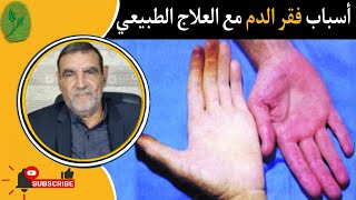 أسباب فقر الدم مع العلاج الطبيعي مع الدكتور محمد الفائد dr mohamed faid