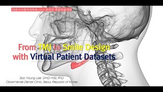 Virtual Patient Datasets 구성을 위한 3D 환자데이터 Superimposition Align 방법 Tutorial - 2021 대한디지털치의학회 학술대회 영상