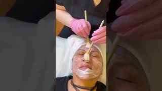 Stem Cell Facial featuring EXOE® + ULTRA+