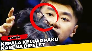 Kepala Keluar Paku karena Dipelet - Karma