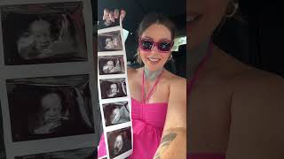 What Did My 29 Week 4D Ultrasound Show? #pregnant #ultrasound