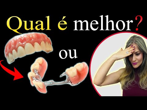 Vídeo: Próteses Dentárias - Que Tipo De Dentadura é Melhor?