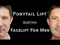 Facelift For Men Before and After Video - Ponytail Lift™ - Kao Plastic Surgery