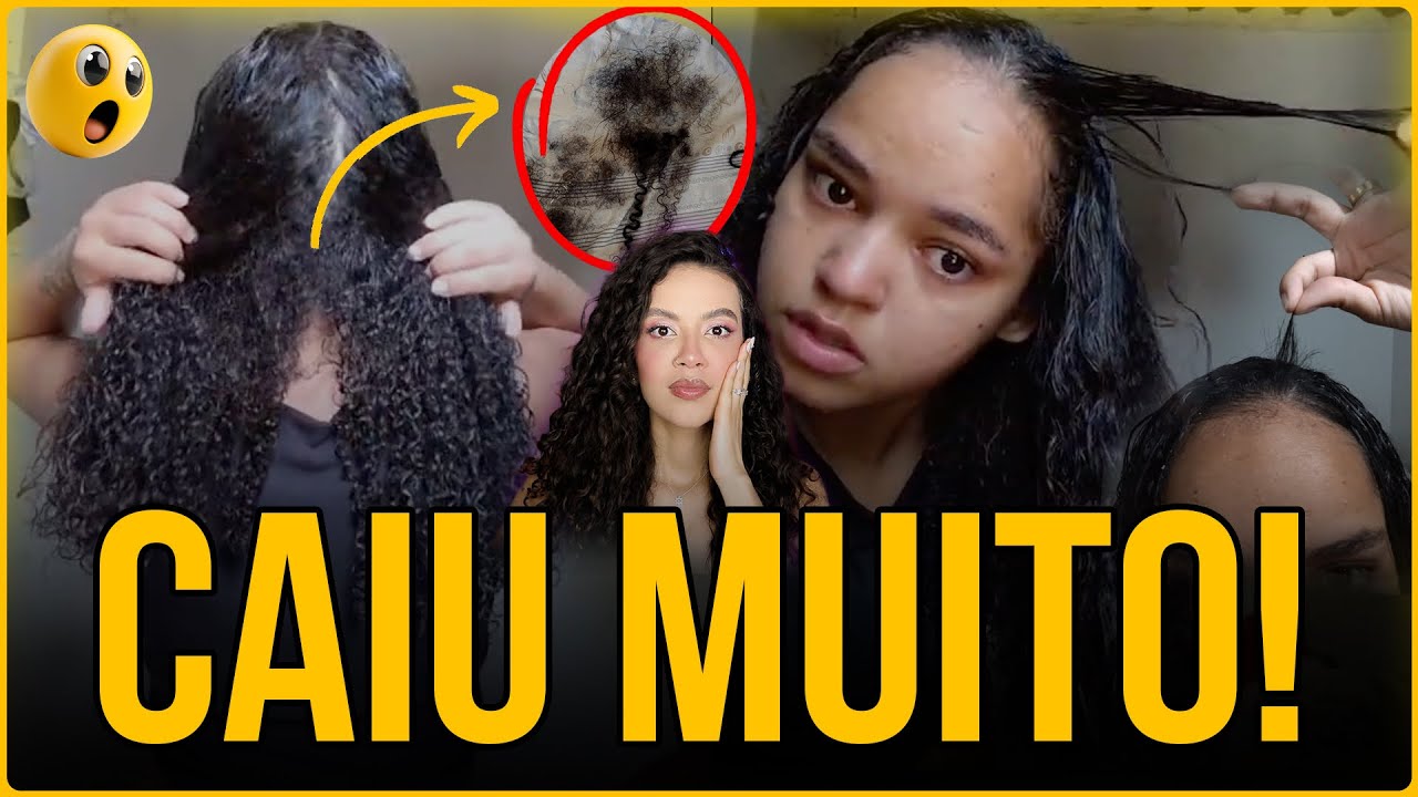 MENINA PERDEU OS CACHOS POR FALSA CAUTERIZAÇÃO!! CUIDADO!!