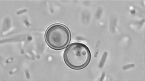 Artificial Cell Mimics “Eating” E. coli Bacteria