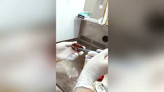 Ecbu Examen Bactériologique Des Urines