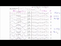 Discrete Fourier Transform Equation Explained