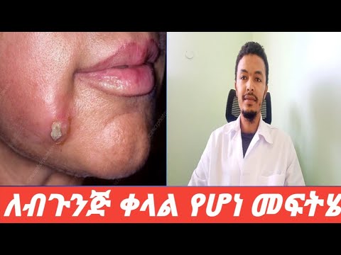 ቪዲዮ: እንዴት ነው በእጅ የሚተፋው?