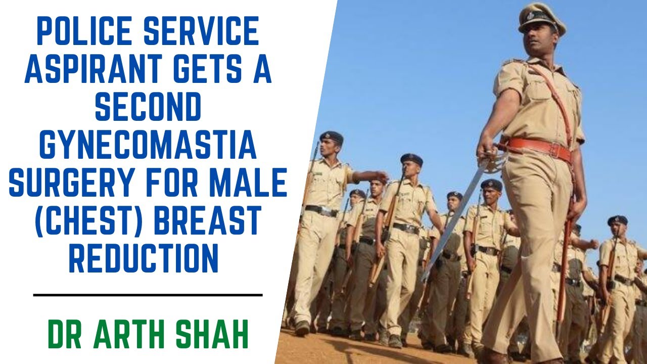 police-service-aspirant-gets-a-second-gynecomastia-surgery-for-male