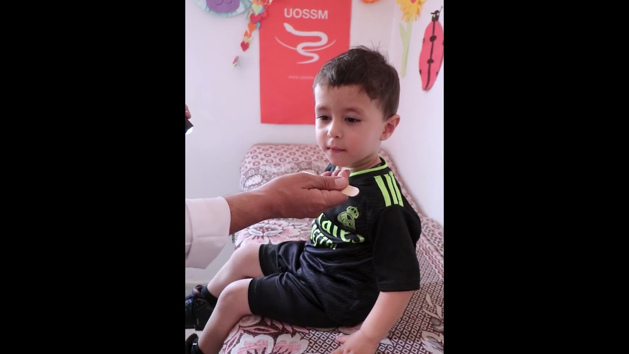 ماهو مرض الحصبة؟ ماهي أعراضه وطرق انتقاله وكيفية الوقاية منه؟