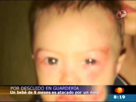 Beb de 9 Meses Atacado en Guardera de Puerto Valla...