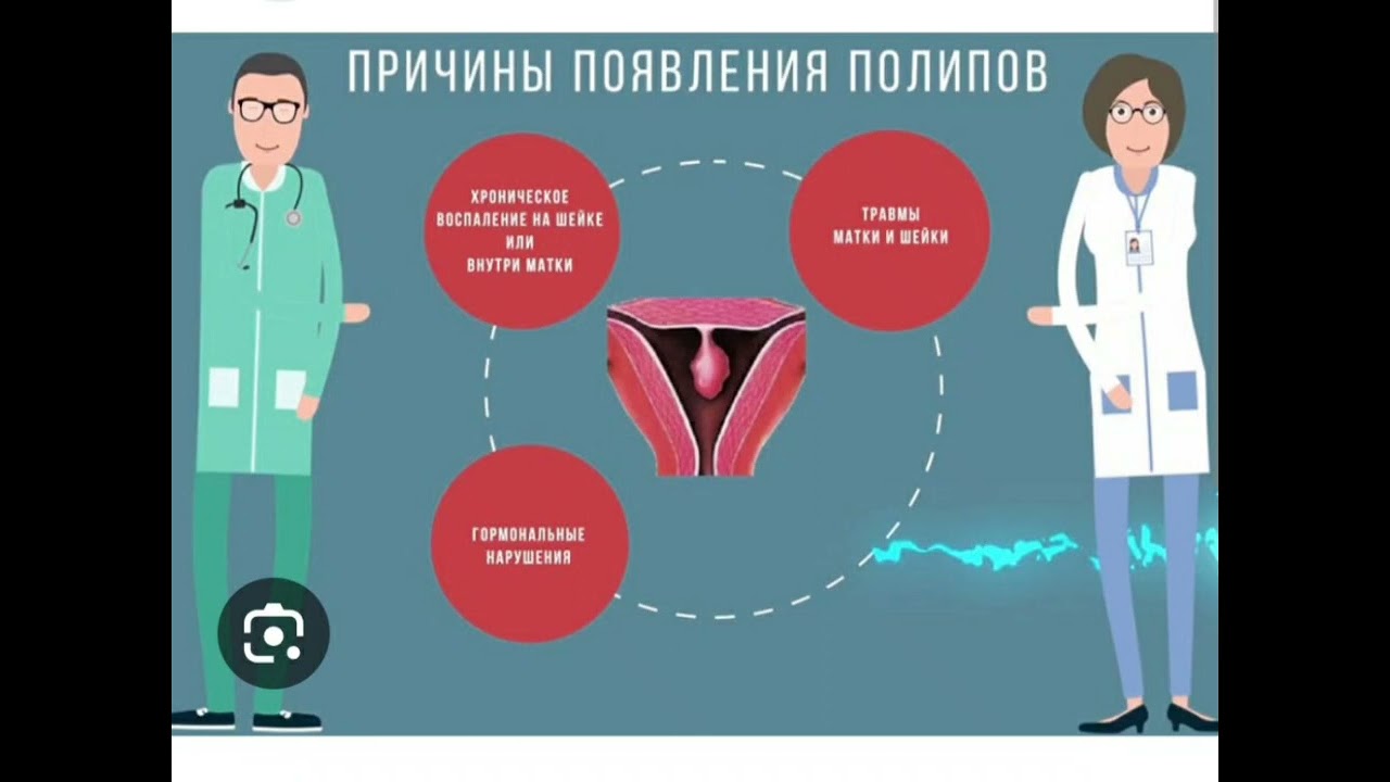 Секс После Удаления Полипа Секс После Удаления Полипа