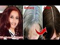 Shahnaz Husain Hair Tips For Grey Hair~Permanently Turn Grey(White) Hair into Black hair~Priya Malik
