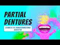 Partial Dentures vs Implants vs Bridges — When a Removable Partial Is Actually the Smart Option