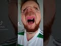 Celtic fan defends Brendan Rodgers #celticfc #brendanrodgers #glasgow #scottish #funny #spfl #celtic