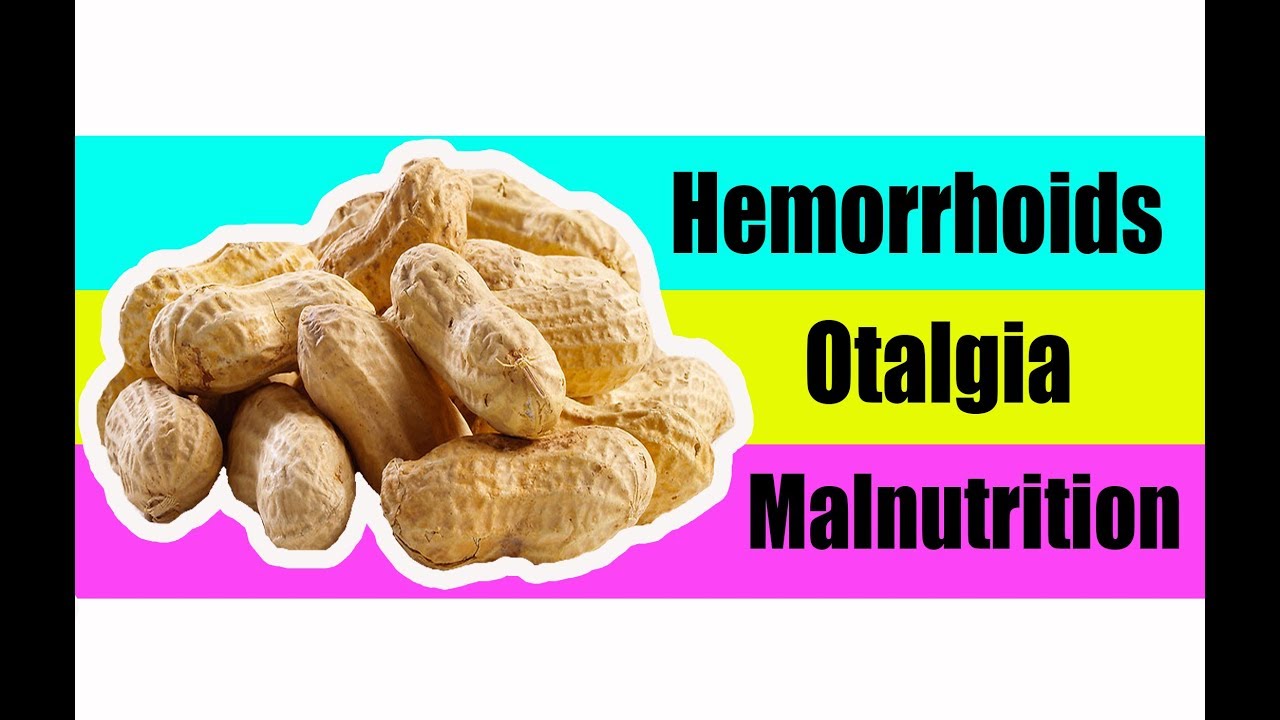 Peanut | Healing Wonders of Plants vegetables high in potassium