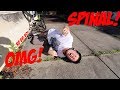 THE WORST SPINAL OF THE YEAR!