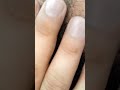 "Long hair slowly message therapy #ingrownhairremoval #asmr #salon #blackheads