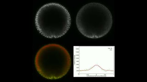 Dorsal-GFP nuclear gradient