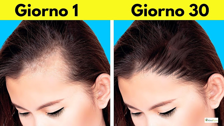 The SHOCKING Discovery About Hair Loss: What They’ve Been Hiding From You!
