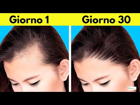 Video: Come Trattare la Caduta dei Capelli nelle Donne (con Immagini)