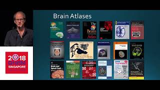 OHBM 2018 | Symposium | John D. Van Horn | Multivariate morphological brain signatures
