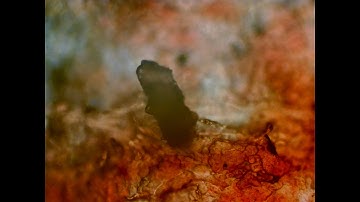 Zoom inside an apple