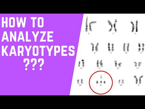 How to Analyze Karyotypes 101