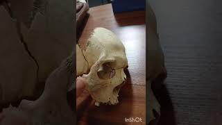 para nasal sinus