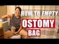 How To Empty Ostomy Bag